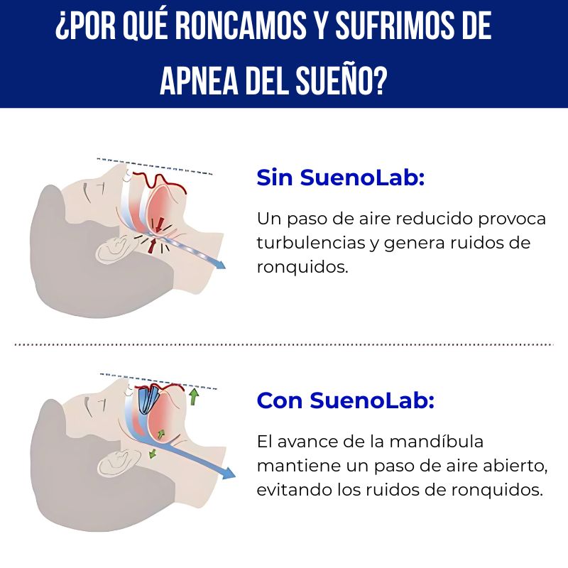 BeQuiet™ No Más Ronquidos Desde la Primera Noche