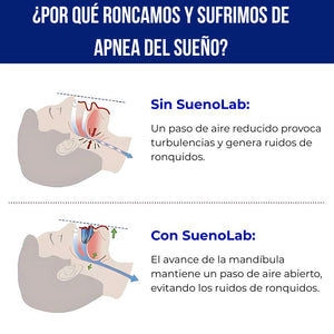 BeQuiet™ No Más Ronquidos Desde la Primera Noche